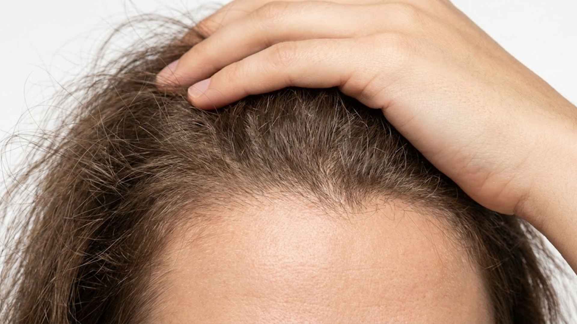 Frizzy Halo: Smoothing the Frizz at the Crown