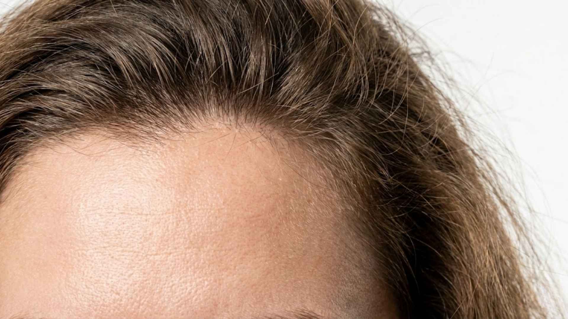 Greasy Roots But Dry Frizzy Ends: Your Full Guide
