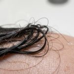 Hair Falling Out in Clumps in the Shower
