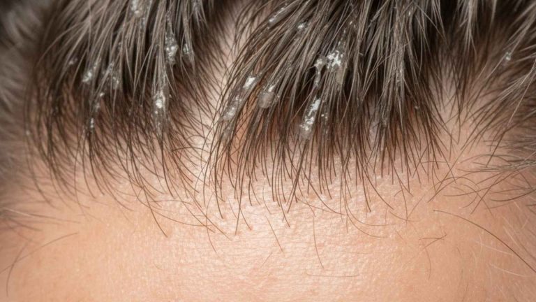 Hair Feels Sticky After Washing