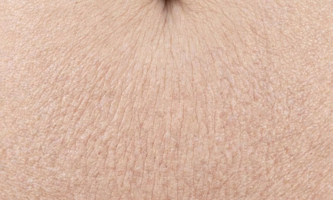 Loose Crepeyon Stomach Skin