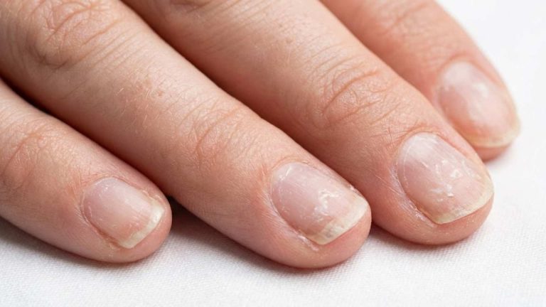 Nails Paper Thin After Gel Removal? Here’s What to Know