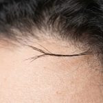 Split Ends That Travel Up the Shaft