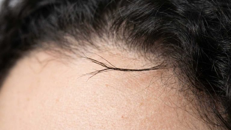 Split Ends That Travel Up the Shaft