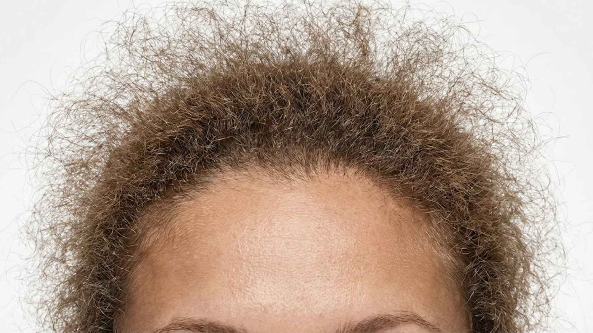 The Frizzy Halo That Won't Smooth Down